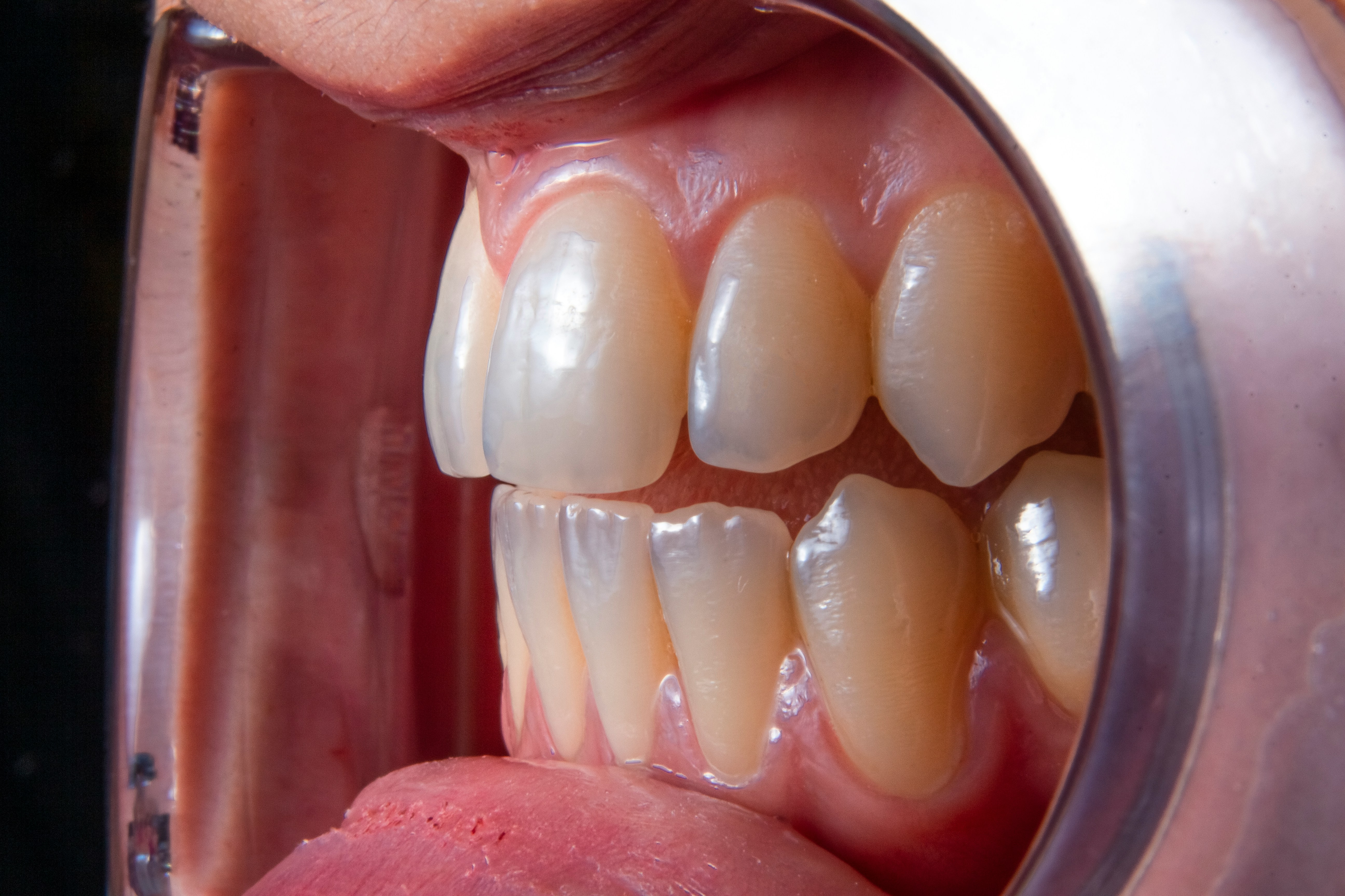Dental Equipment